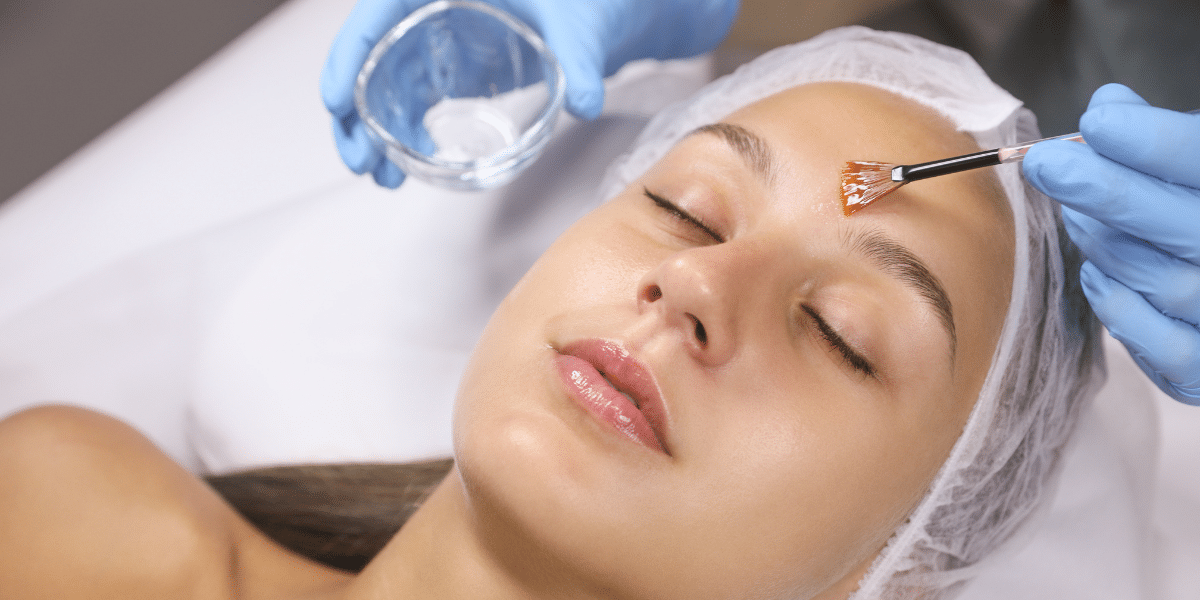 The Benefits of Chemical Peels: How They Can Improve Your Skin’s Appearance